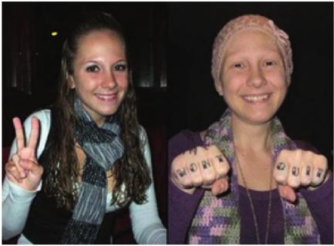 Ashley Kirilow, before and after altering her appearance to fake cancer.